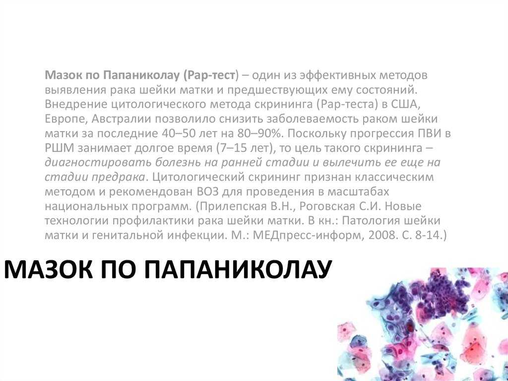 Мазок по папаниколау (пап-тест) или мазок на онкоцитологию | «за рождение» киров