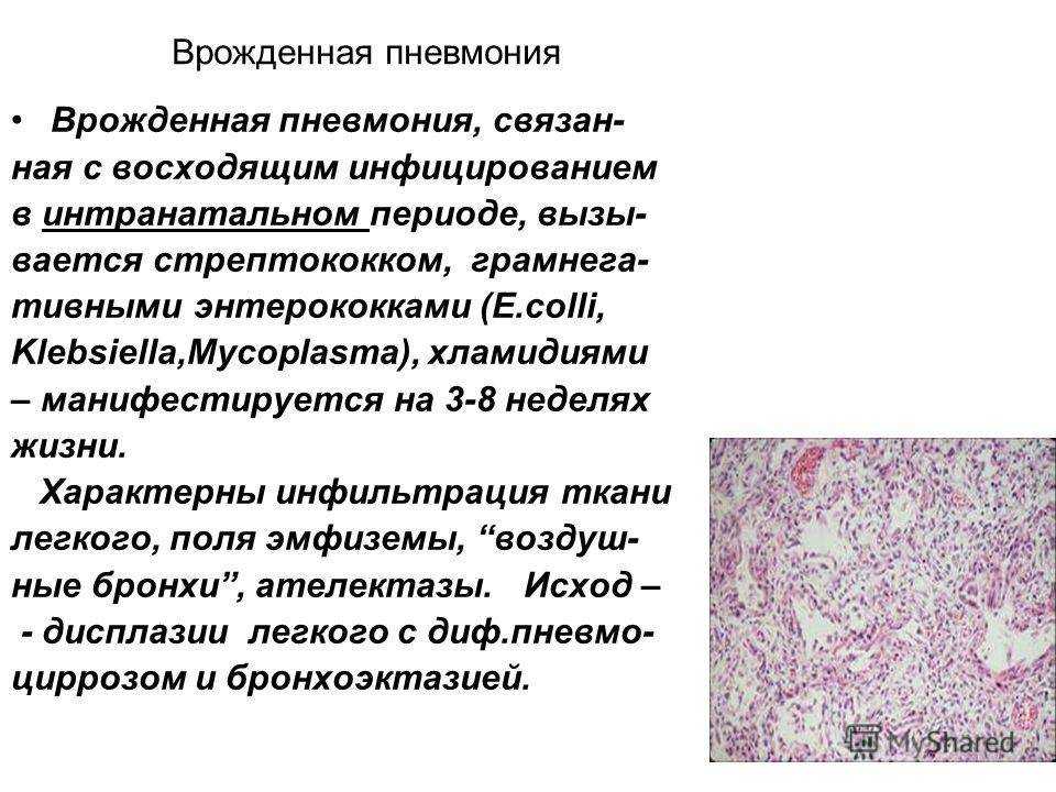 Энтеробиоз у детей - причины заражения, симптомы, лечение, опасность заболевания, профилактика | см-клиника