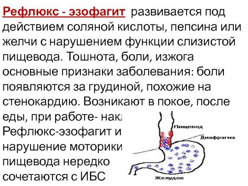 Отрыжка: причины, механизм развития, к кому обратиться?