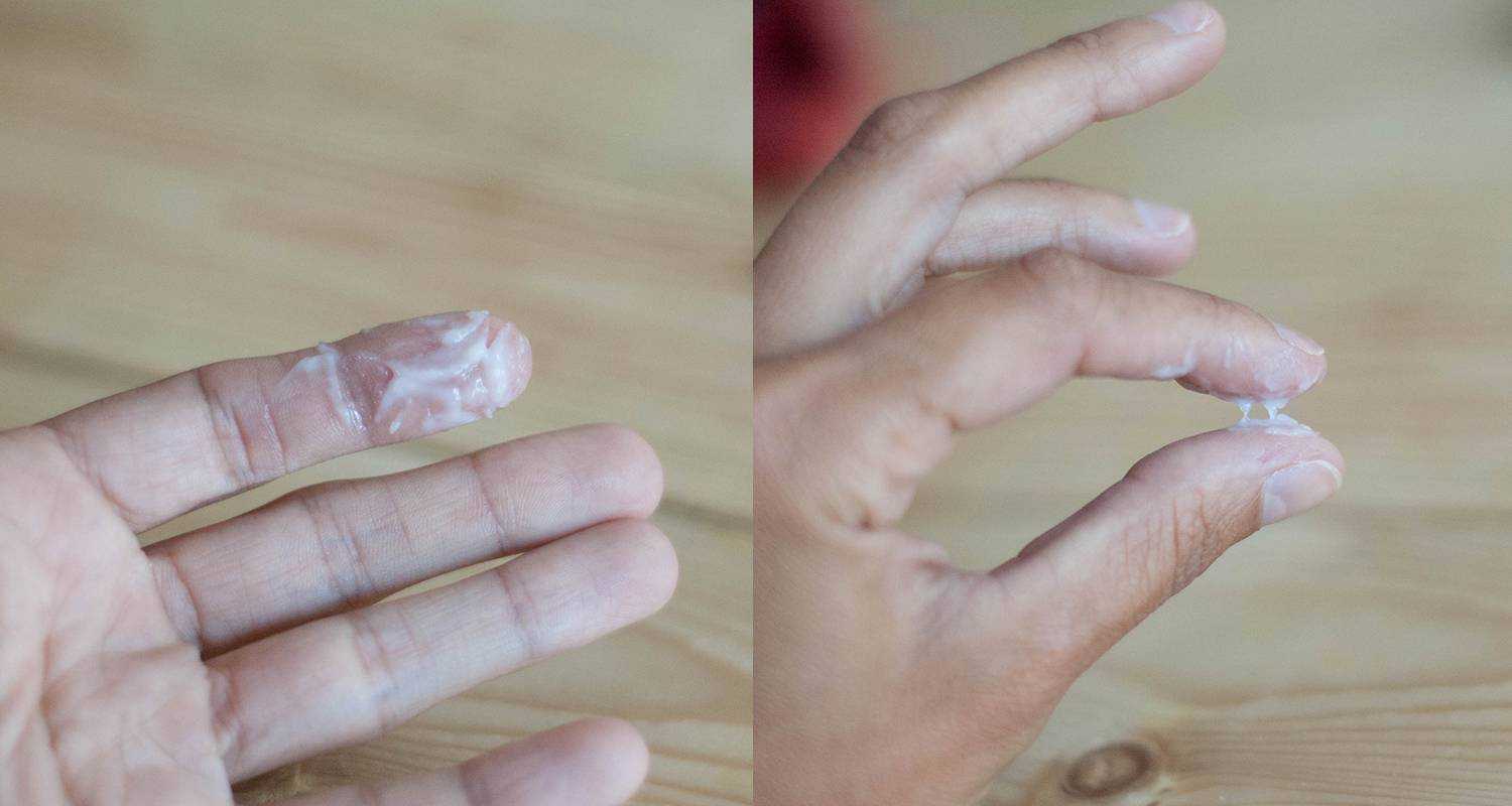 Выделения с запахом у женщин