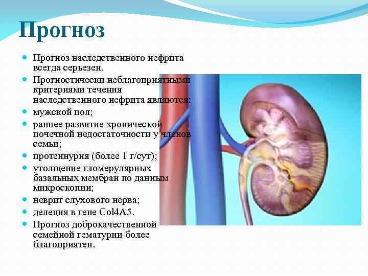 Альпорта синдром