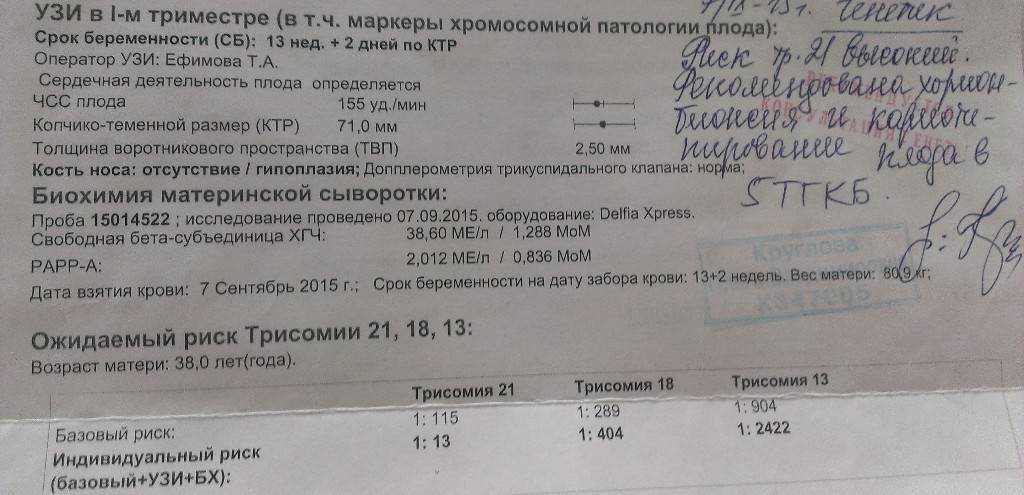 Плацентарный мозаицизм при беременности с высоким риском трисомии 16 по результатам полногеномного неинвазивного пренатального днк-скрининга анеуплоидий