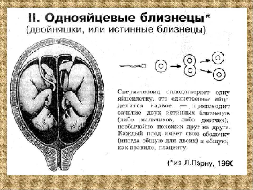 Разнояйцевые близнецы