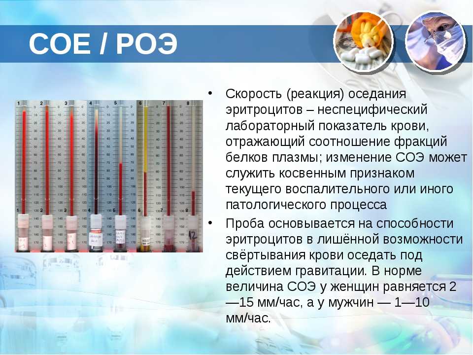 Анализ соэ: как расшифровывается и для чего применяется в диагностике