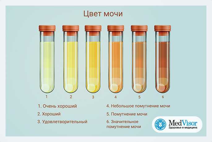 Какого цвета должна быть моча у здорового