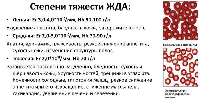 Дефицит железа при беременности