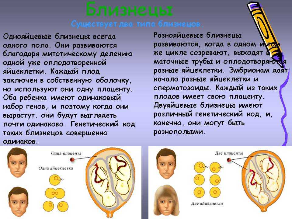 Однояйцевые близнецы: интересные факты и отличия