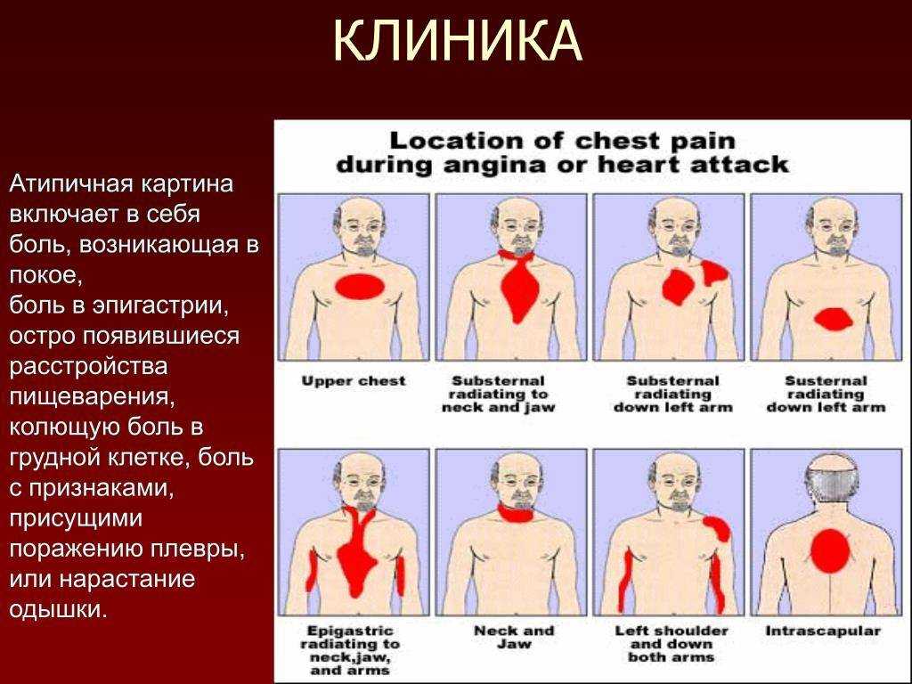 Боль в спине под левой лопаткой