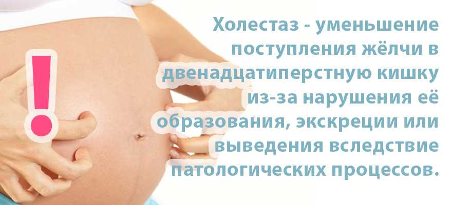 Понятие холестаза беременных, его причины и симптомы Способы диагностики, лечения и профилактики, возможные осложнения