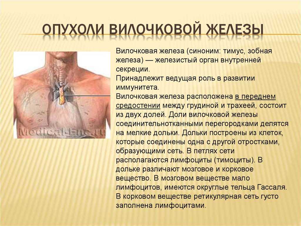 Тимомегалия у детей: 16 причин, 3 вида, 4 группы симптомов, 2 подхода к лечению