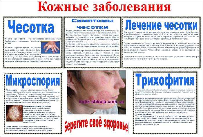 Как отличить потницу от аллергии у грудничка: советы и рекомендации