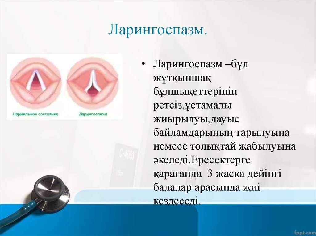 Ларингоспазм