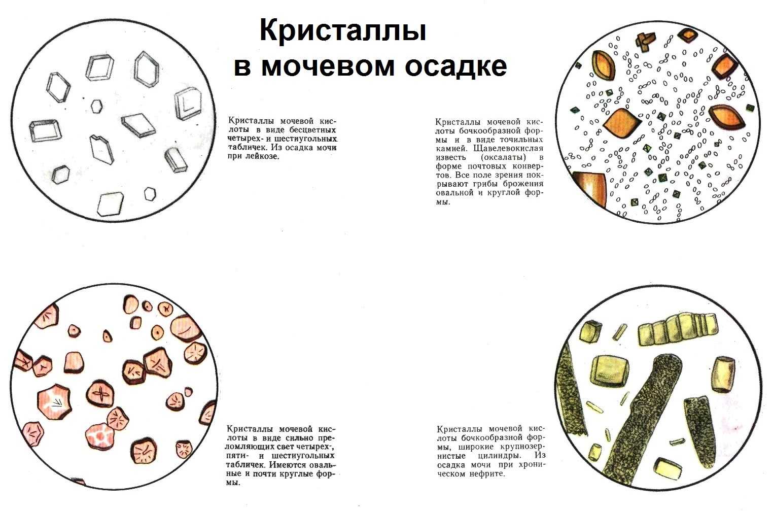 Осадки мочи микроскопия. Микроскопия мочи бактерии. Микроскопия осадка норма. Кристаллы цистина в моче животных. Микроскопия осадка мочи интерпретация.