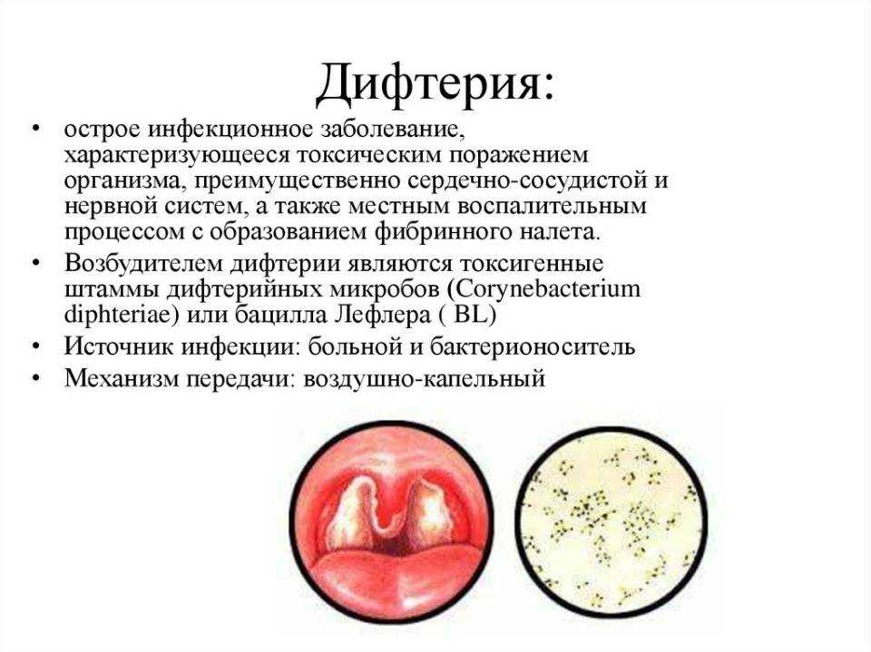 Бактериолог о стрептококке и стрептококковой инфекции: виды, патогенность, симптоматика, лечение