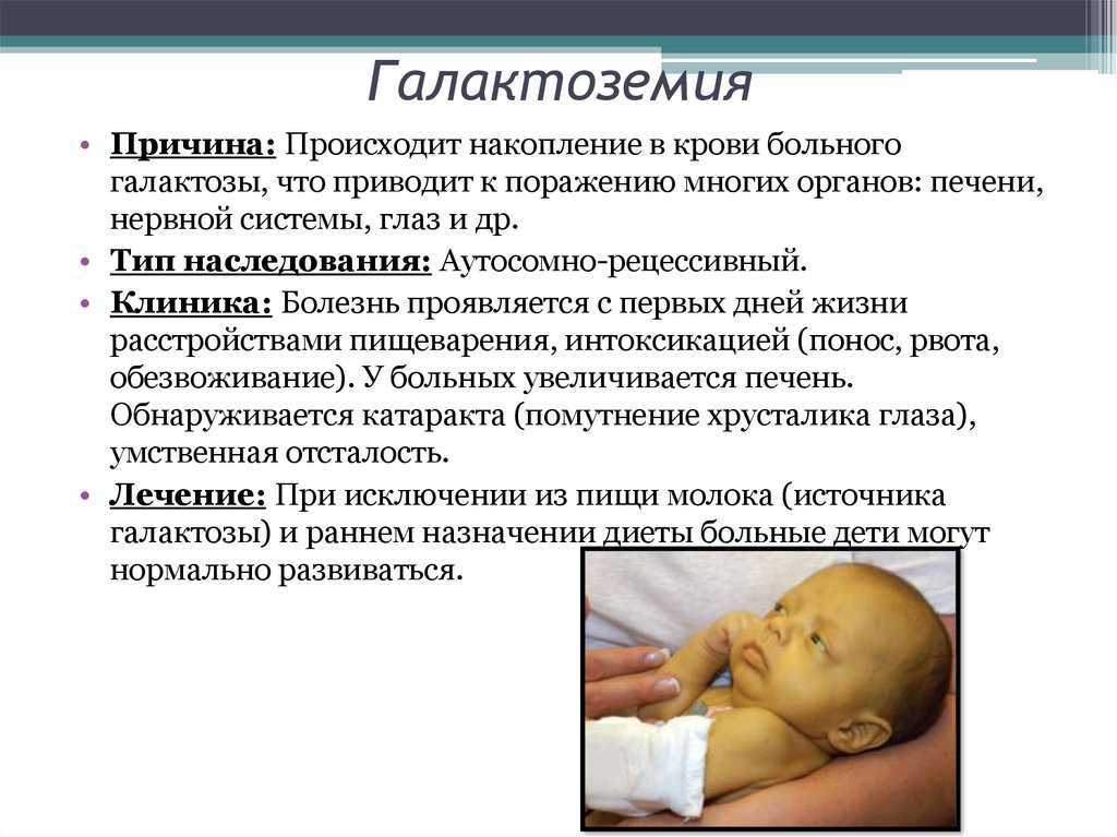 Актуальные вопросы диагностики и лечения врожденных аритмий