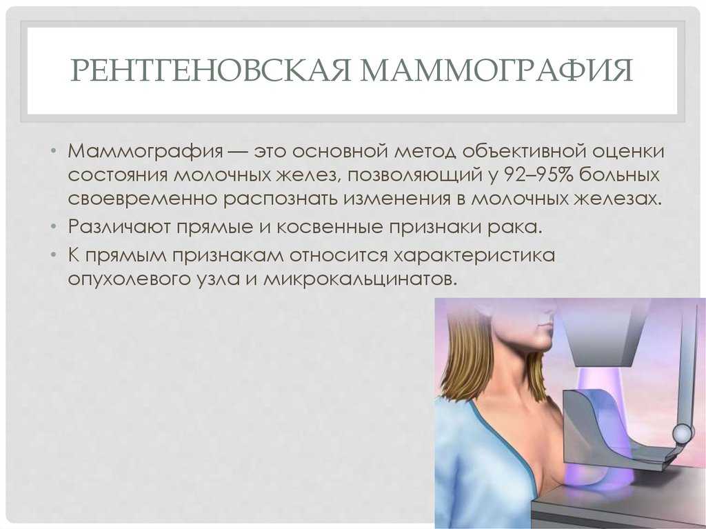 Операции при раке молочной железы