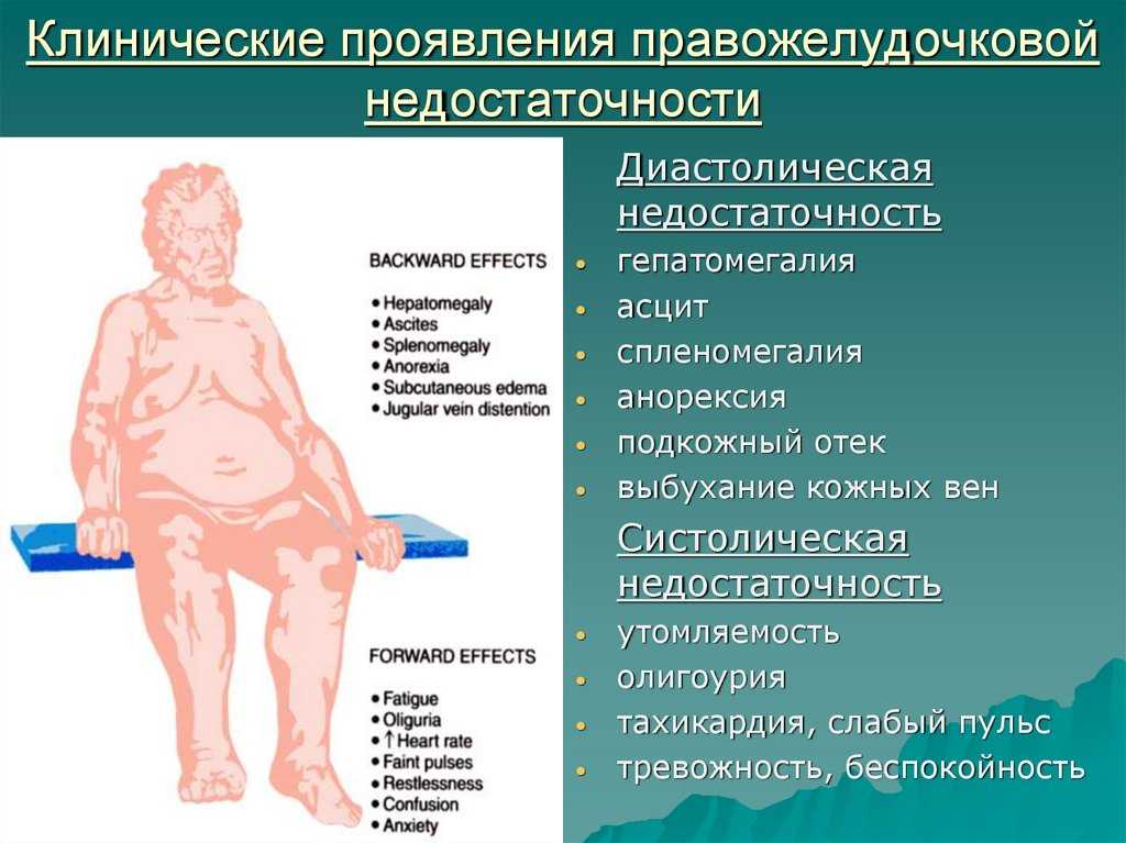 Пентада Кантрелла у плода: описание, причины и признаки заболевания, лечение порока внутриутробного развития