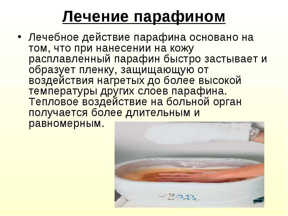 Парафинотерапия