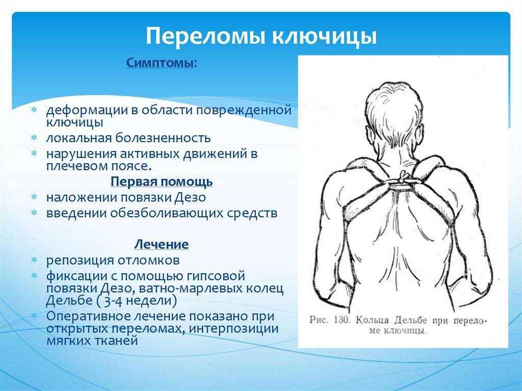 Вывих: первая помощь. что надо делать и чего нельзя делать при вывихе