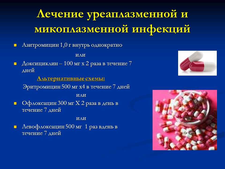 Уреаплазмоз