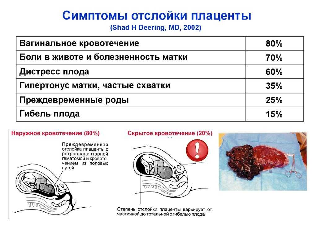 Выделения после эко: норма и патологии