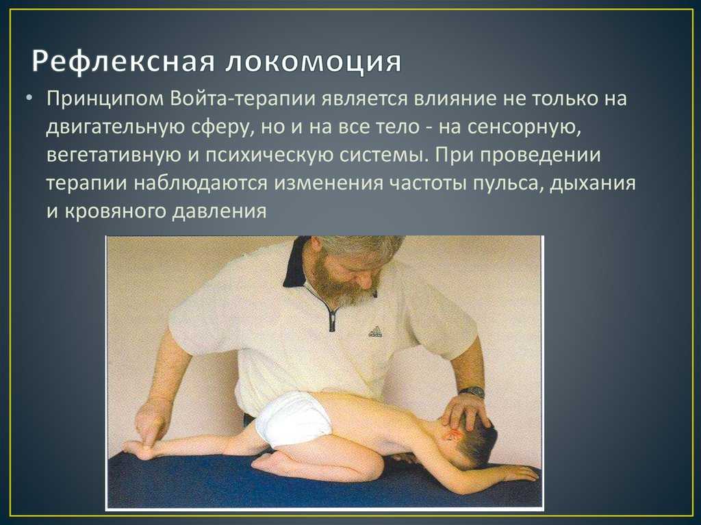 Войта-терапия для грудничков: что это такое, принципы, как делать и что дает