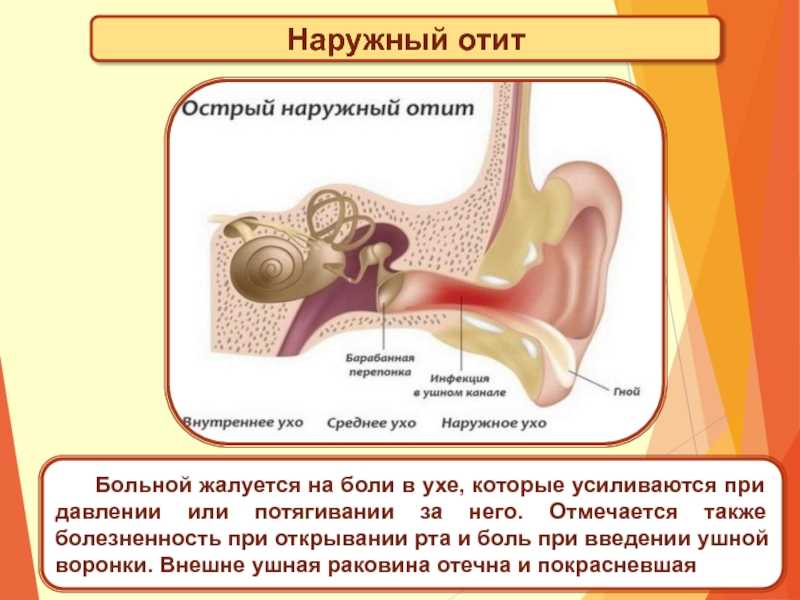 Экссудативный средний отит у детей. симптомы, причины и лечение