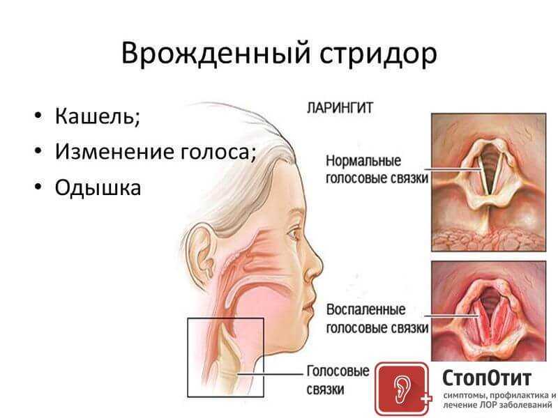 Желтуха у новорожденных - причины, виды, симптомы, методы диагностики и лечения | см-клиника