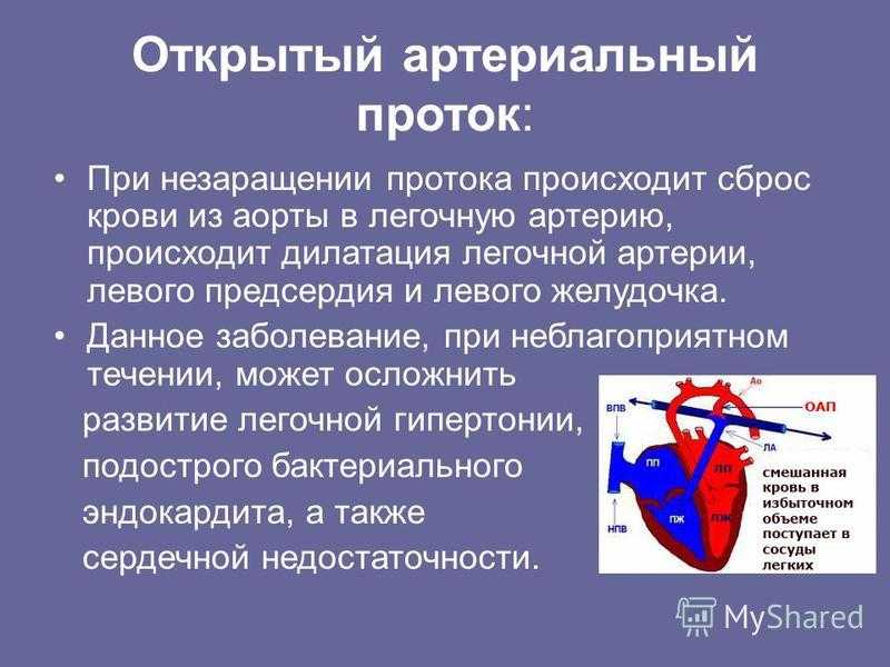 Открытый артериальный проток - krascor.ru