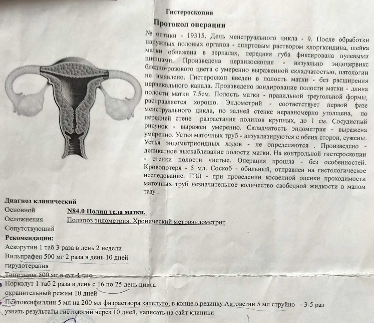 Жидкость в маточной трубе: 5 причин возникновения и 4 метода лечения